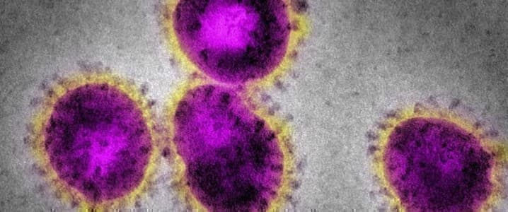 Coronavirus Coronavirus